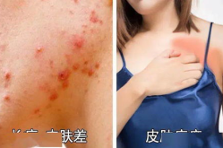 夏天私密发臭,夏日私密异味困扰全解析